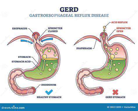 MedicalTreatmentsforGERDandAnxiety