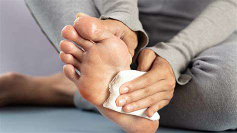 HolisticApproachestoSweatyFeetManagement